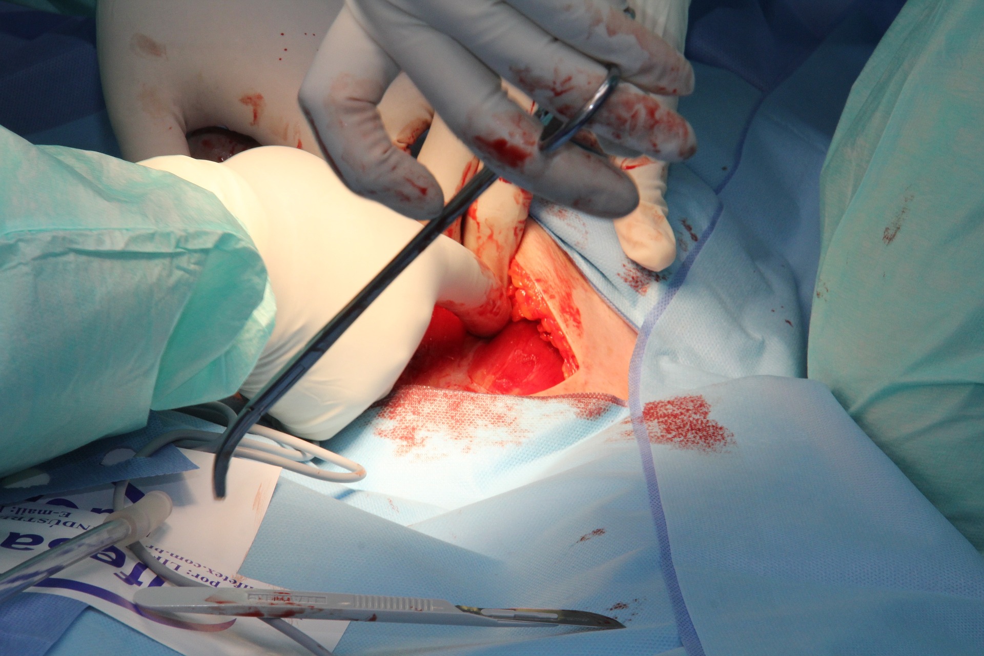 Chirurgia plastyczna w Polsce